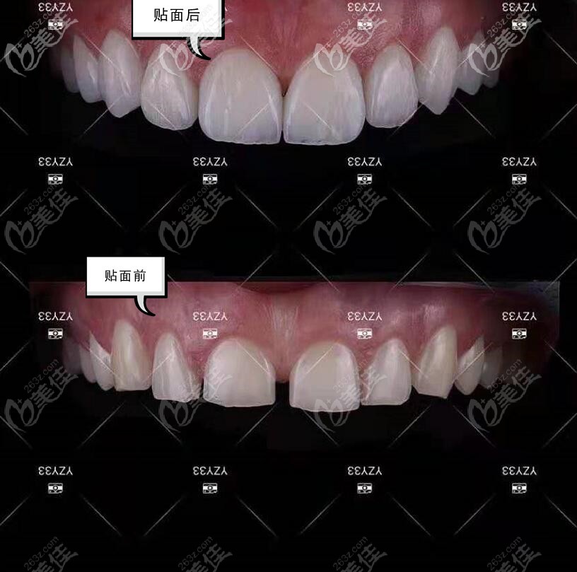 面相图解宽牙缝过大怎么办_牙缝过宽面相图解_牙缝宽命好